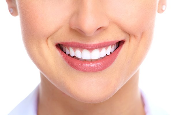 Everything You Need to Know About Veneers in Edmonton